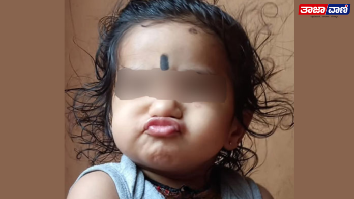 Brahmavar A coconut fell on a one-and-a-half-year-old child, Daksh, who was in his mother's arms in Heranje and died tragically!