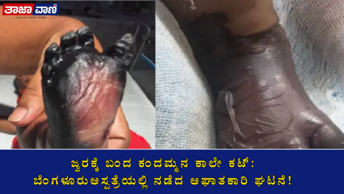 Bengaluru: Toes of a 57-day-old infant, taken to the hospital for a fever, get amputated! Parents express outrage over medical negligence.